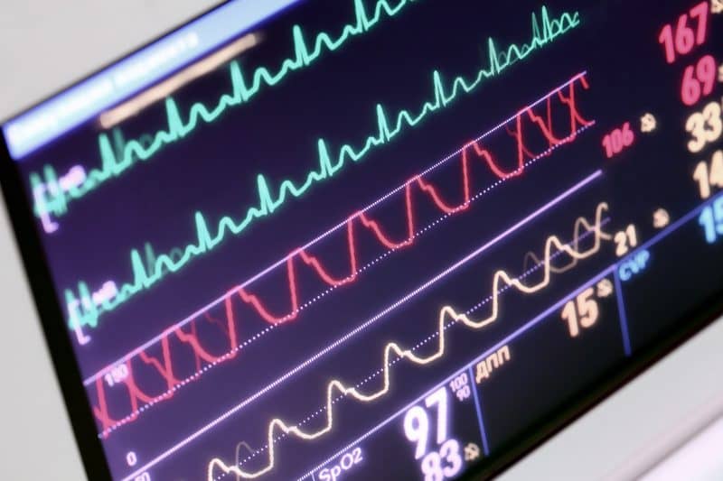 Tips for Testing Patient Monitors
